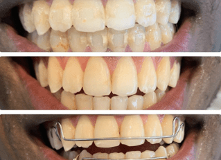 Patient smile results