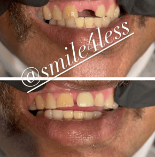 Dental transformation