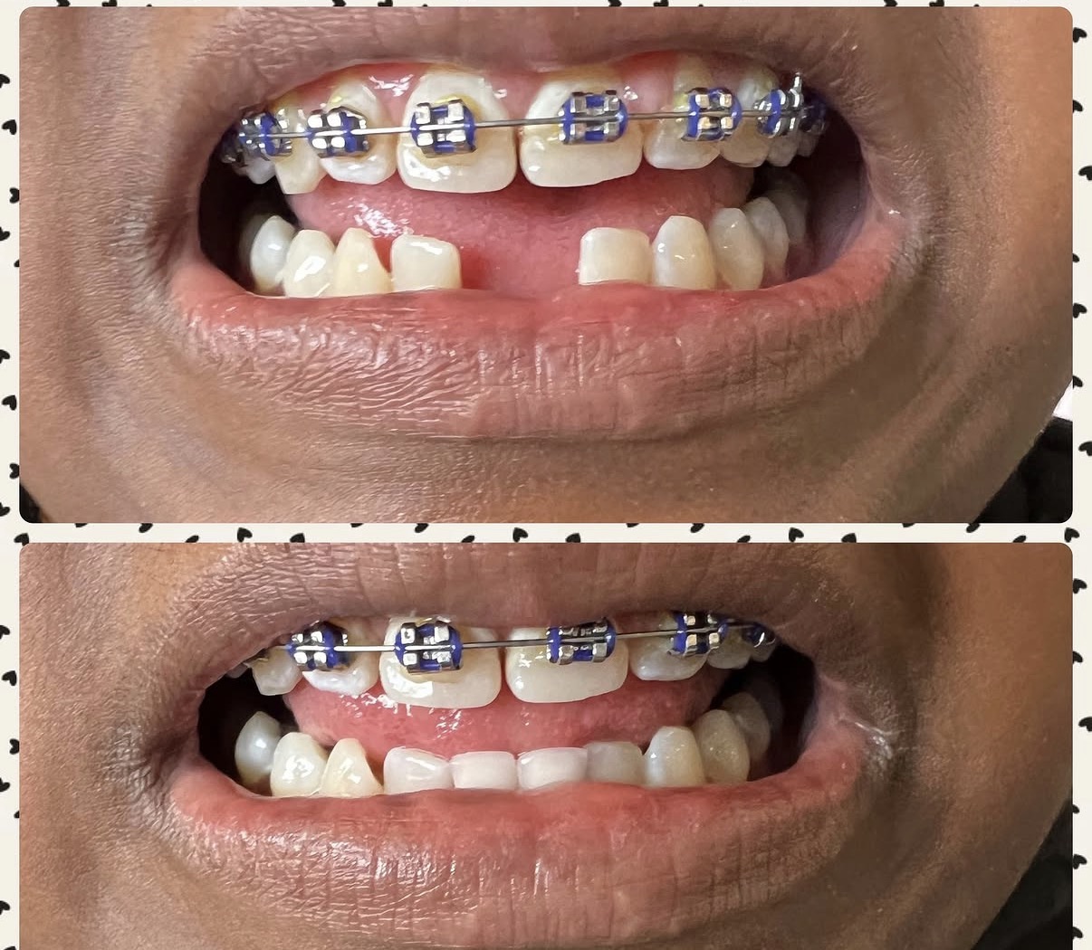 Patient transformation at Smile4Less LA