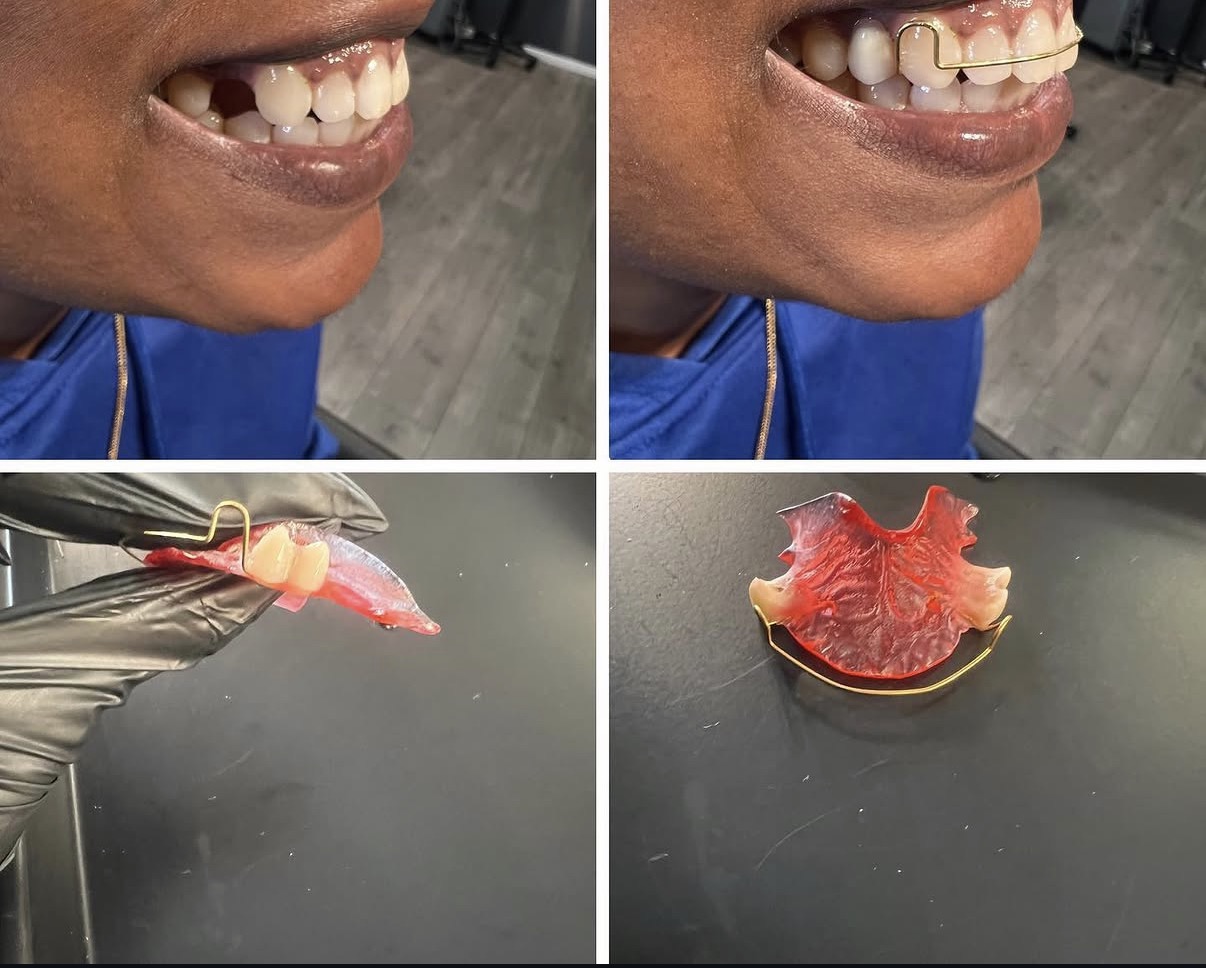 Smile transformation Smile4Less