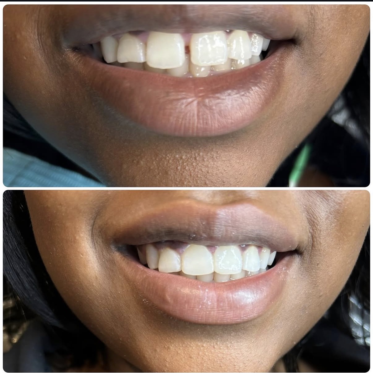 Dental work patient result